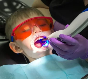 Root Canal Infection in Children