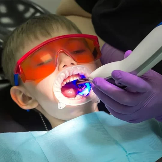 Root Canal Infection in Children